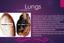 effects of smoking on lungs