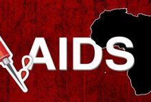 HIV Aids Symptoms