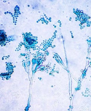Penicillium sp. (blue green molds)